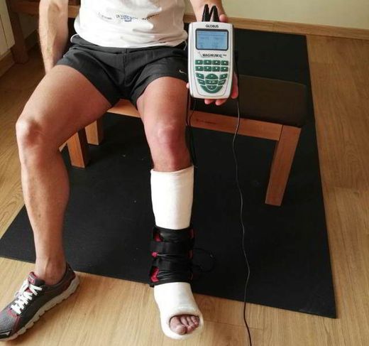 Magnetoterapia, en que consiste y sus beneficios en rehabilitación.