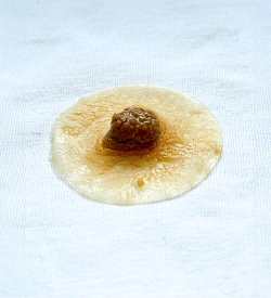 Brustwarzen- und Warzenhofprothesen