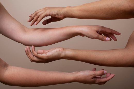 Ortesis de Brazo/ muñeca