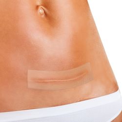 Rechteckiger Silikonverband für Wunden und Verbrennungen