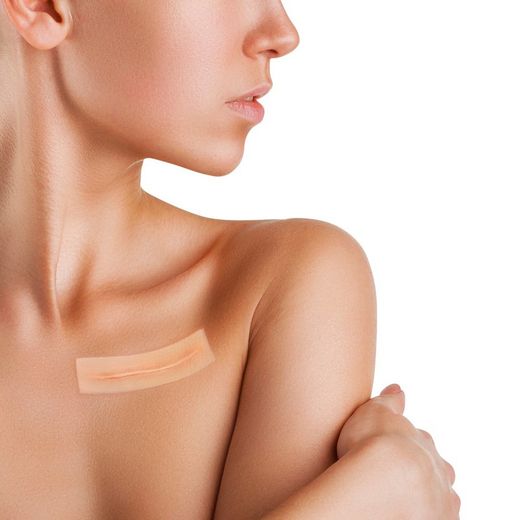 Rechteckiger Silikonverband für Wunden und Verbrennungen