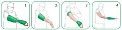 Arion Easy-Slide-Arm, für Lymphödem-Ärmel