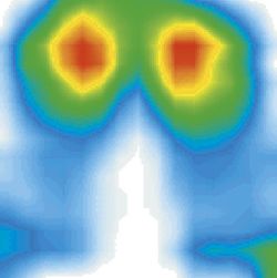 Coussin anti-escarres viscoélastique anatomique Viscoflex c7a