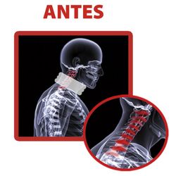Collarin cervical inflable