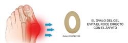 comodihallux