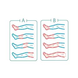 Professioneller Pressotherapie-Kompressor mit 4 Ausgängen Advance