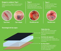 Fresco Skin Tear Protection Kleidung für dünne Haut