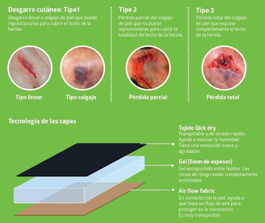 Fresco Skin Tear Protection Kleidung für dünne Haut