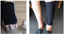 Fresco Skin Tear Protection Kleidung für dünne Haut