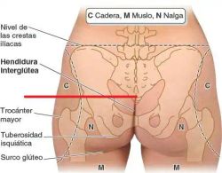 Spinomed® Rückenorthese bei Osteoporose