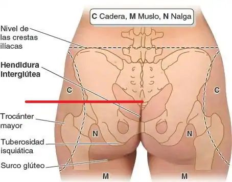 Spinomed® Rückenorthese bei Osteoporose